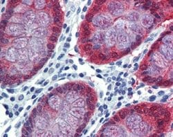 HOXC8 Rabbit anti-Human, Polyclonal, Novus Biologicals 100 &mu;g; Unconjugated:Antibodies,